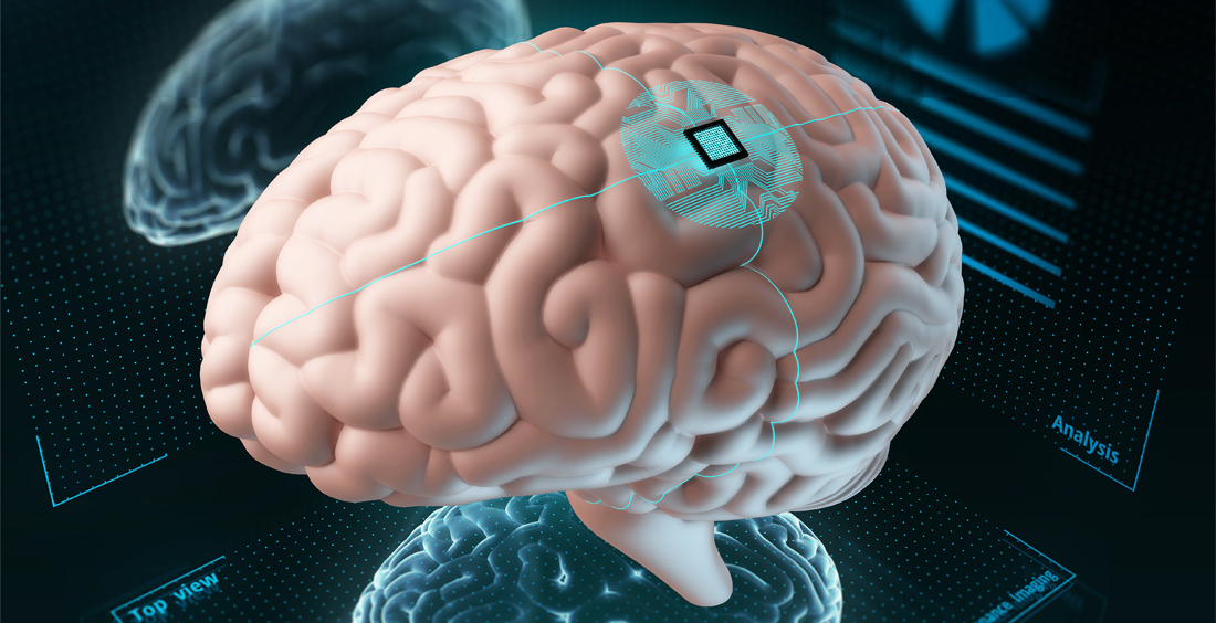 Implantes cerebrales electrónicos: más cerca de lo que creemos